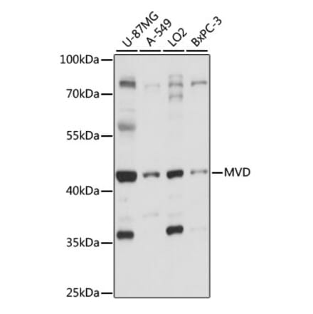 Western Blot - Anti-MVD Antibody (A89869) - Antibodies.com