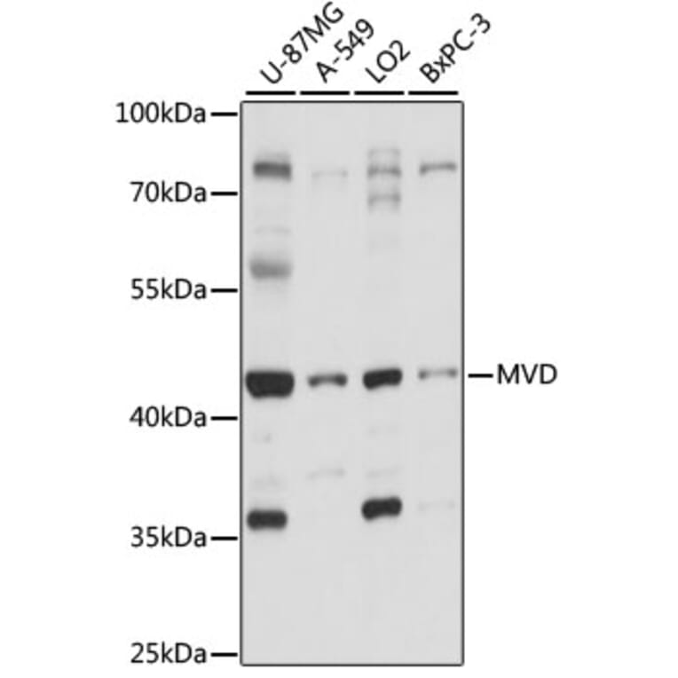Western Blot - Anti-MVD Antibody (A89869) - Antibodies.com