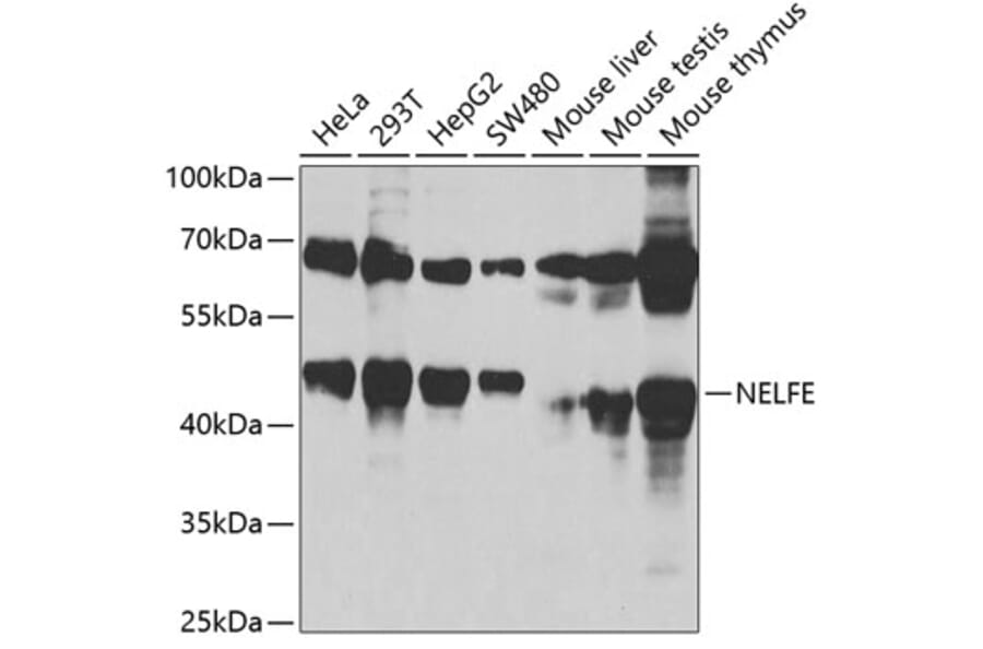 Western Blot - Anti-NELFe Antibody (A89870) - Antibodies.com