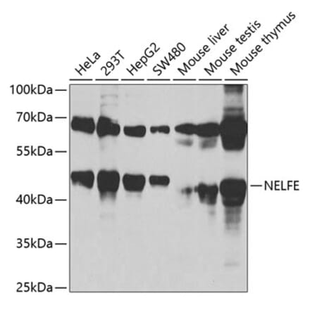 Western Blot - Anti-NELFe Antibody (A89870) - Antibodies.com