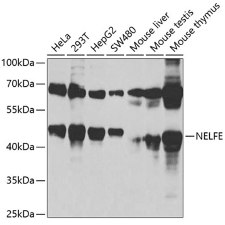 Western Blot - Anti-NELFe Antibody (A89870) - Antibodies.com