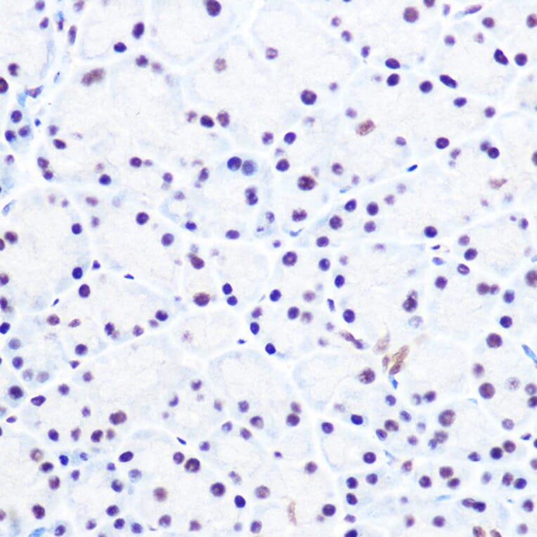 Immunohistochemistry - Anti-NELFe Antibody (A89870) - Antibodies.com