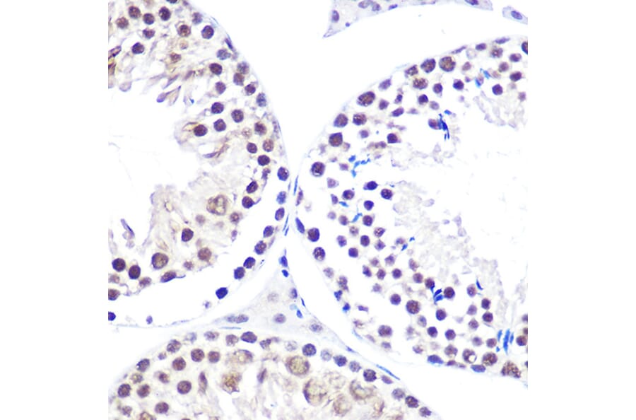 Immunohistochemistry - Anti-NELFe Antibody (A89870) - Antibodies.com