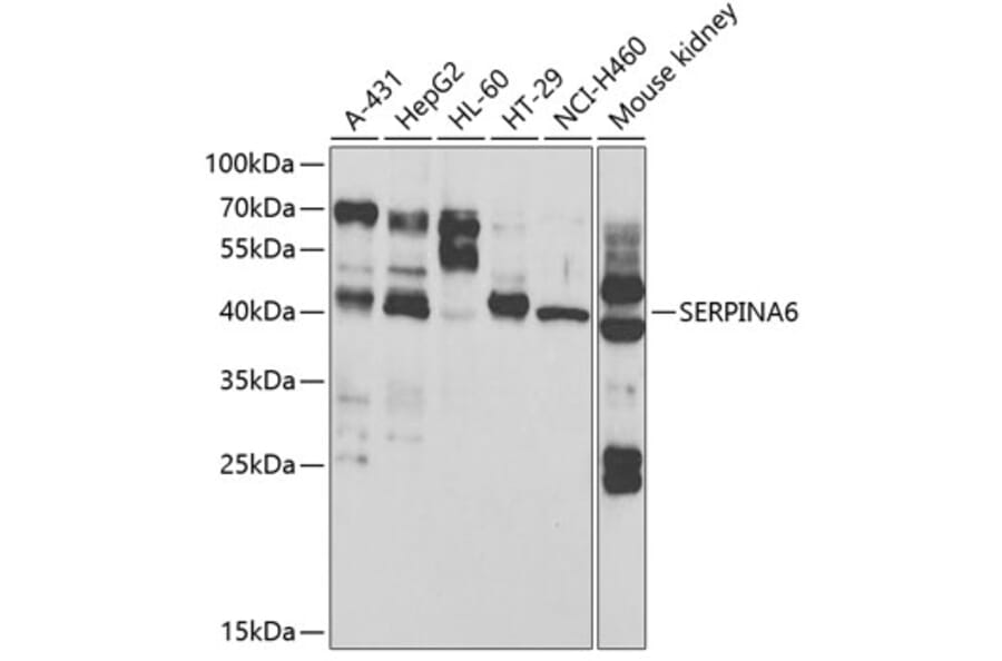 Western Blot - Anti-SERPINA6 Antibody (A13609) - Antibodies.com