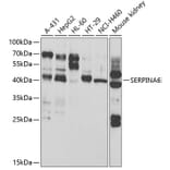 Western Blot - Anti-SERPINA6 Antibody (A13609) - Antibodies.com