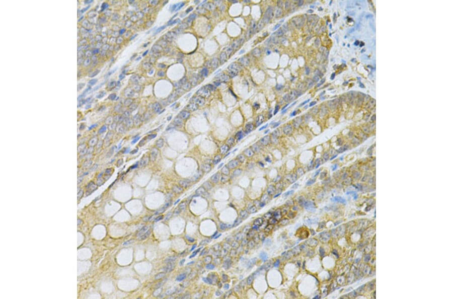 Immunohistochemistry - Anti-SERPINA6 Antibody (A13609) - Antibodies.com