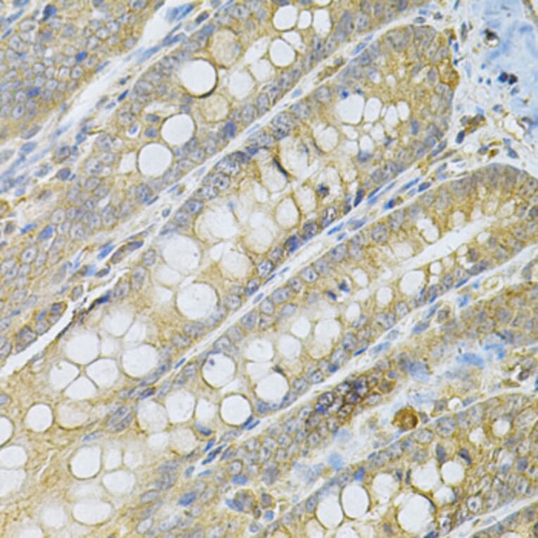 Immunohistochemistry - Anti-SERPINA6 Antibody (A13609) - Antibodies.com