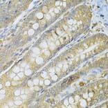 Immunohistochemistry - Anti-SERPINA6 Antibody (A13609) - Antibodies.com