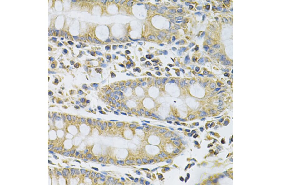 Immunohistochemistry - Anti-SERPINA6 Antibody (A13609) - Antibodies.com