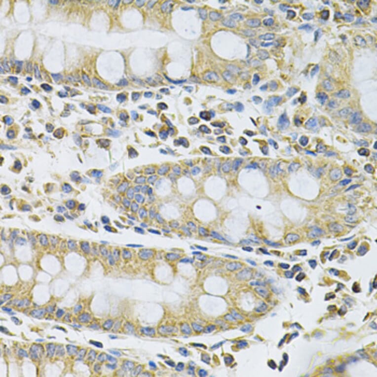 Immunohistochemistry - Anti-SERPINA6 Antibody (A13609) - Antibodies.com