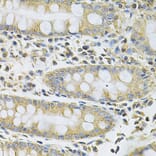 Immunohistochemistry - Anti-SERPINA6 Antibody (A13609) - Antibodies.com