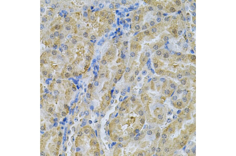 Immunohistochemistry - Anti-SERPINA6 Antibody (A13609) - Antibodies.com
