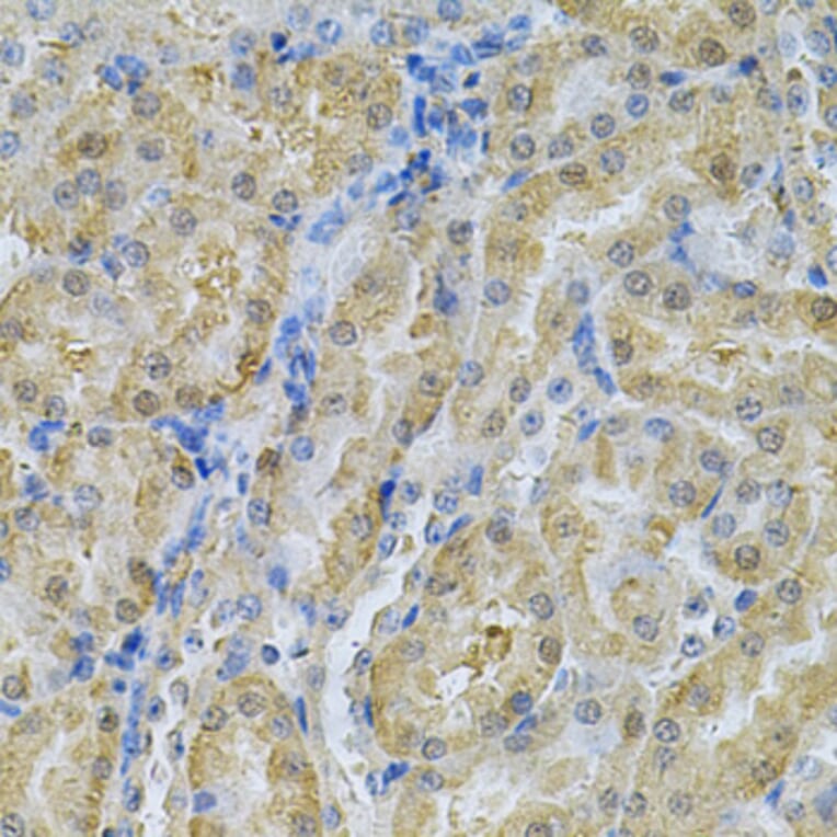 Immunohistochemistry - Anti-SERPINA6 Antibody (A13609) - Antibodies.com