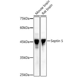Western Blot - Anti-SEPT5 Antibody (A89872) - Antibodies.com