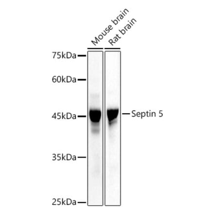 Western Blot - Anti-SEPT5 Antibody (A89872) - Antibodies.com