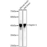 Western Blot - Anti-SEPT5 Antibody (A89872) - Antibodies.com