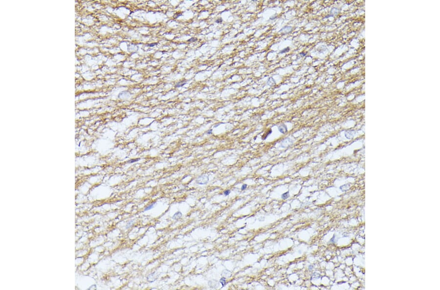 Immunohistochemistry - Anti-SEPT5 Antibody (A89872) - Antibodies.com