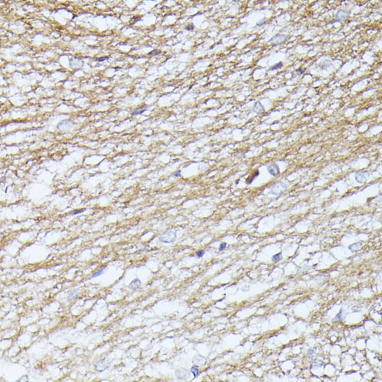 Immunohistochemistry - Anti-SEPT5 Antibody (A89872) - Antibodies.com