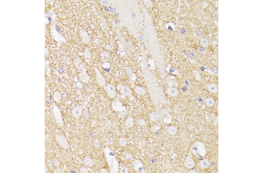 Immunohistochemistry - Anti-SEPT5 Antibody (A89872) - Antibodies.com