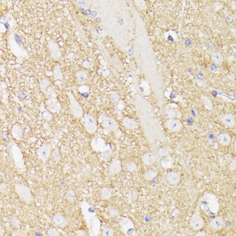 Immunohistochemistry - Anti-SEPT5 Antibody (A89872) - Antibodies.com