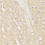 Immunohistochemistry - Anti-SEPT5 Antibody (A89872) - Antibodies.com