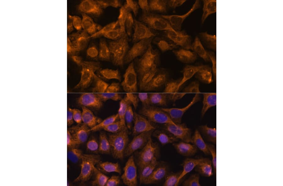 Immunofluorescence - Anti-SEPT5 Antibody (A89872) - Antibodies.com