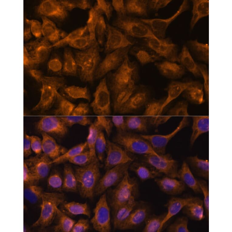 Immunofluorescence - Anti-SEPT5 Antibody (A89872) - Antibodies.com