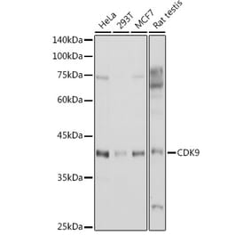 Western Blot - Anti-Cdk9 Antibody (A89874) - Antibodies.com