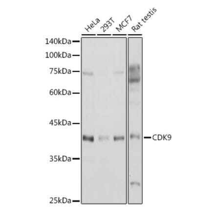 Western Blot - Anti-Cdk9 Antibody (A89874) - Antibodies.com