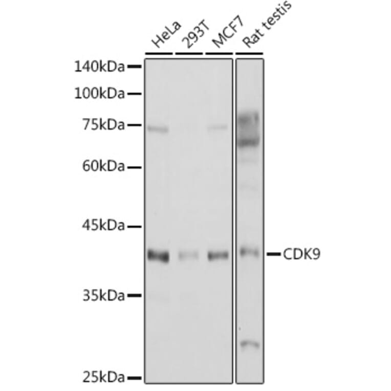 Western Blot - Anti-Cdk9 Antibody (A89874) - Antibodies.com