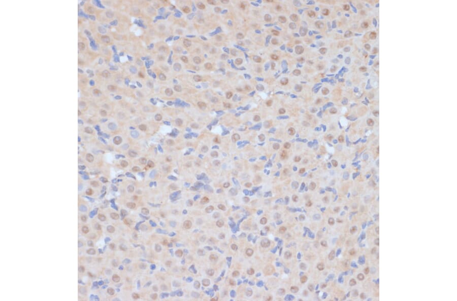 Immunohistochemistry - Anti-Cdk9 Antibody (A89874) - Antibodies.com