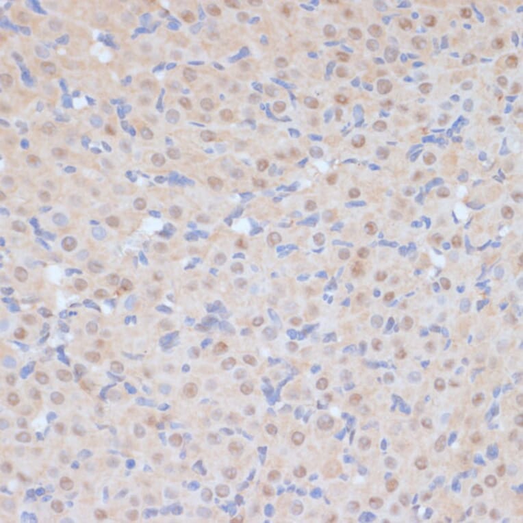 Immunohistochemistry - Anti-Cdk9 Antibody (A89874) - Antibodies.com