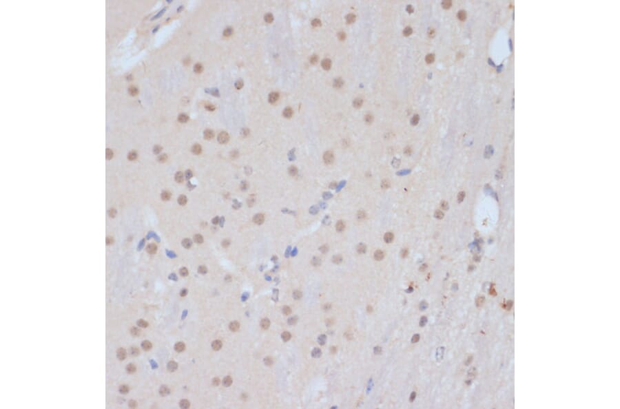 Immunohistochemistry - Anti-Cdk9 Antibody (A89874) - Antibodies.com
