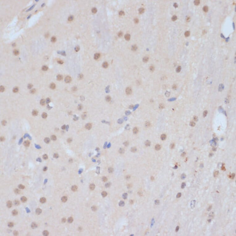 Immunohistochemistry - Anti-Cdk9 Antibody (A89874) - Antibodies.com