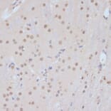 Immunohistochemistry - Anti-Cdk9 Antibody (A89874) - Antibodies.com