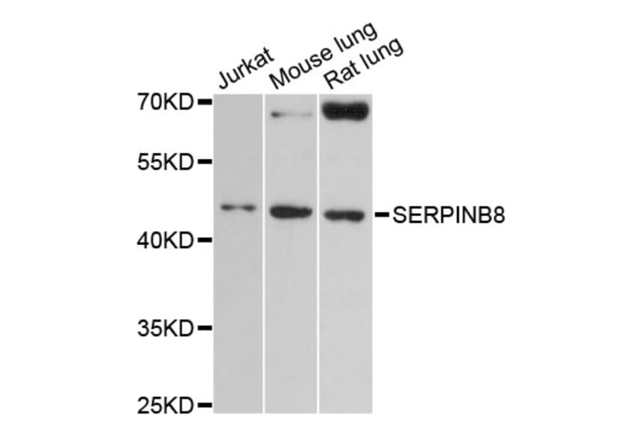 Western Blot - Anti-SERPINB8 Antibody (A13039) - Antibodies.com