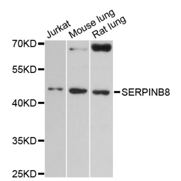 Western Blot - Anti-SERPINB8 Antibody (A13039) - Antibodies.com