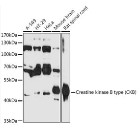 Western Blot - Anti-Creatine Kinase MB Antibody (A89876) - Antibodies.com