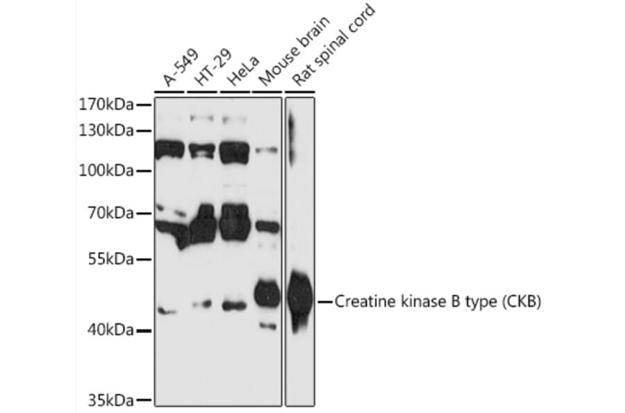 Western Blot - Anti-Creatine Kinase MB Antibody (A89876) - Antibodies.com