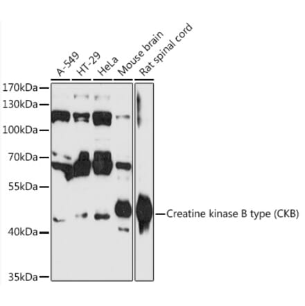 Western Blot - Anti-Creatine Kinase MB Antibody (A89876) - Antibodies.com