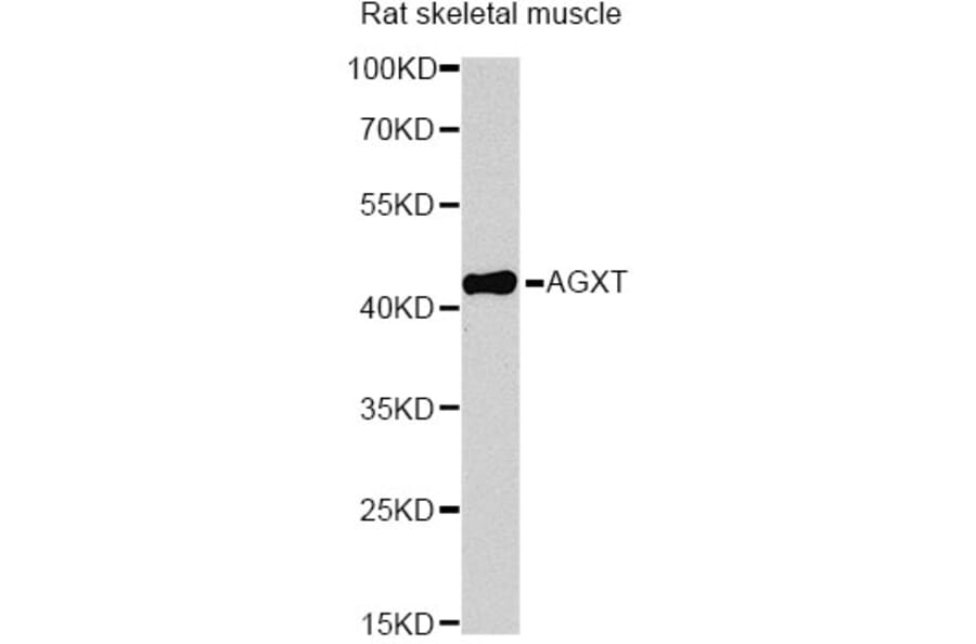 Western Blot - Anti-AGXT Antibody (A13943) - Antibodies.com