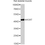 Western Blot - Anti-AGXT Antibody (A13943) - Antibodies.com
