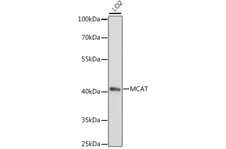Western Blot - Anti-MT Antibody (A89878) - Antibodies.com