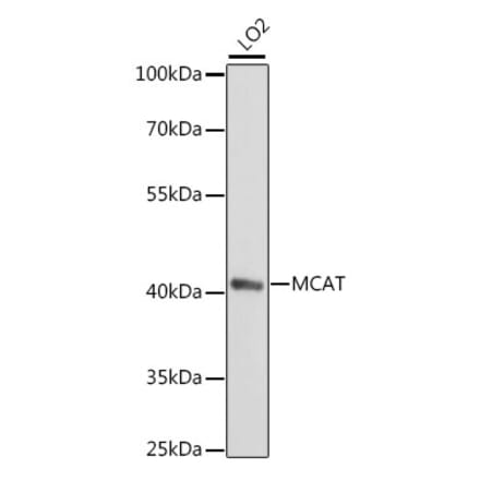 Western Blot - Anti-MT Antibody (A89878) - Antibodies.com