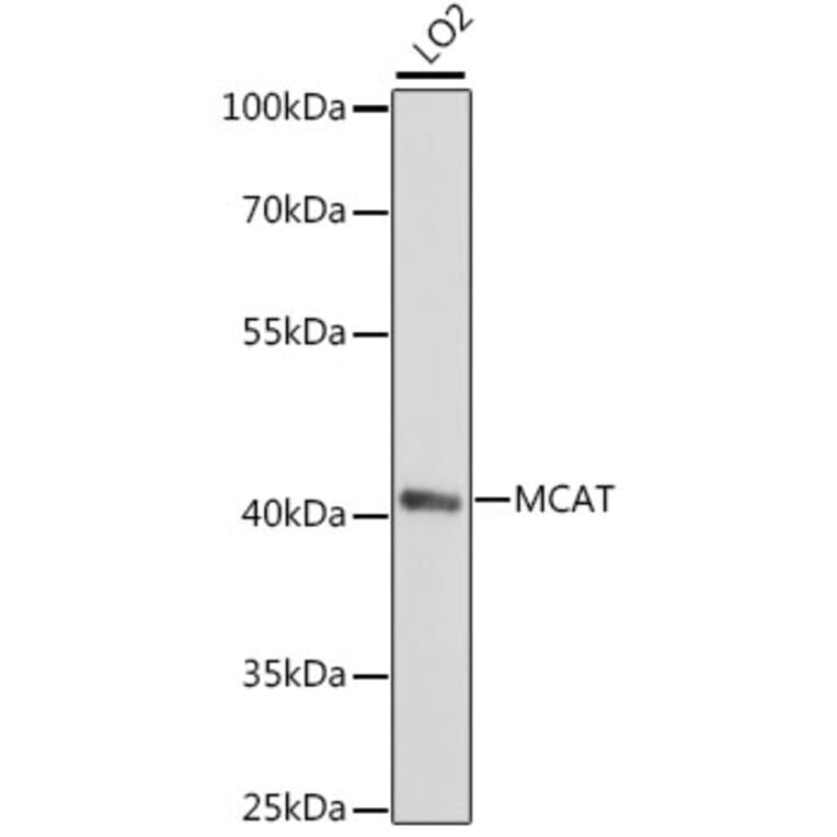 Western Blot - Anti-MT Antibody (A89878) - Antibodies.com