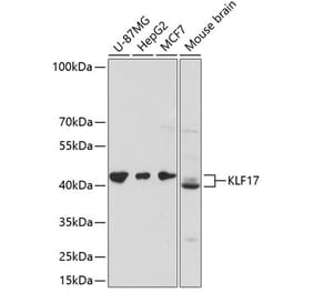 Western Blot - Anti-KLF17 Antibody (A89879) - Antibodies.com