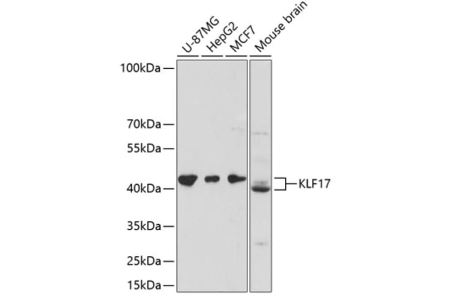 Western Blot - Anti-KLF17 Antibody (A89879) - Antibodies.com
