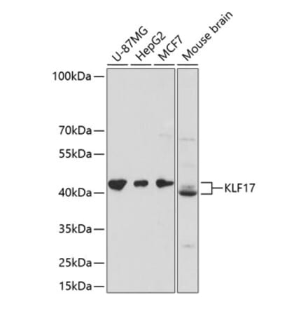 Western Blot - Anti-KLF17 Antibody (A89879) - Antibodies.com