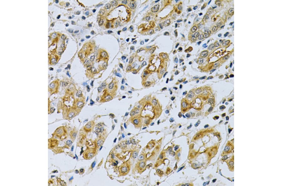 Immunohistochemistry - Anti-MASPIN Antibody (A89880) - Antibodies.com