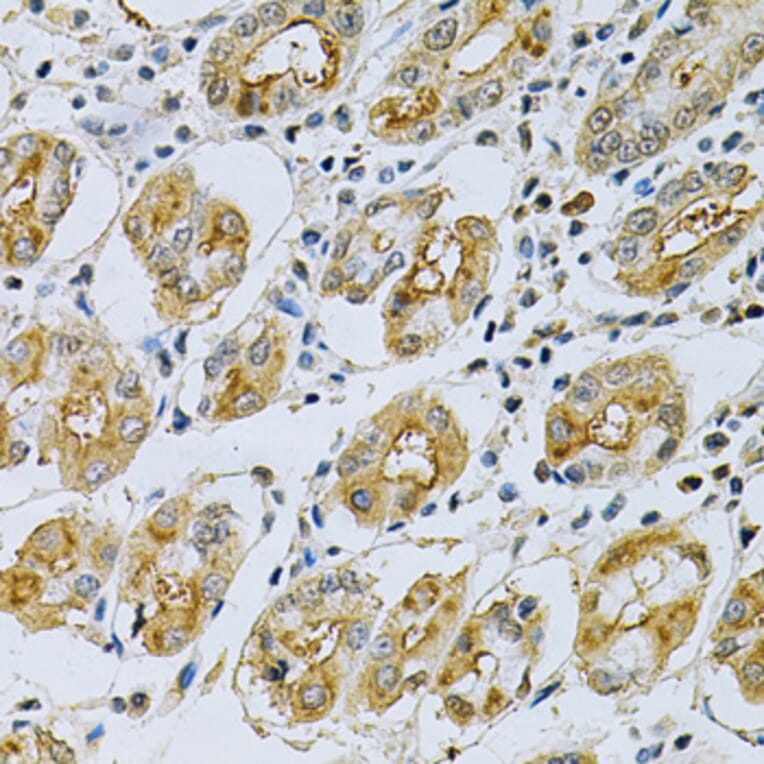 Immunohistochemistry - Anti-MASPIN Antibody (A89880) - Antibodies.com